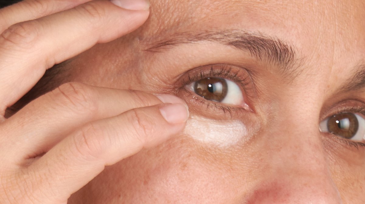 how to get rid of dark circles